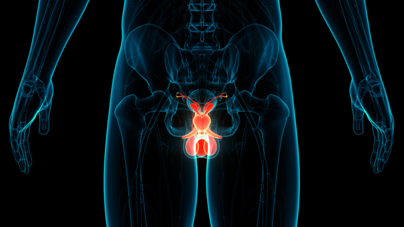 O que reduz em 35% o risco de câncer de próstata?