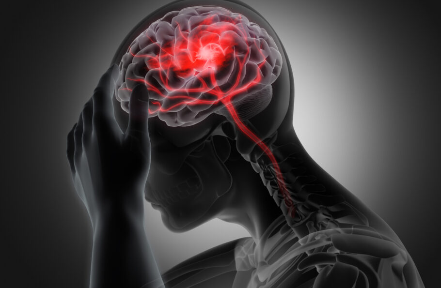 Conheça os sinais de AVC que podem aparecer bem antes do acidente vascular cerebral