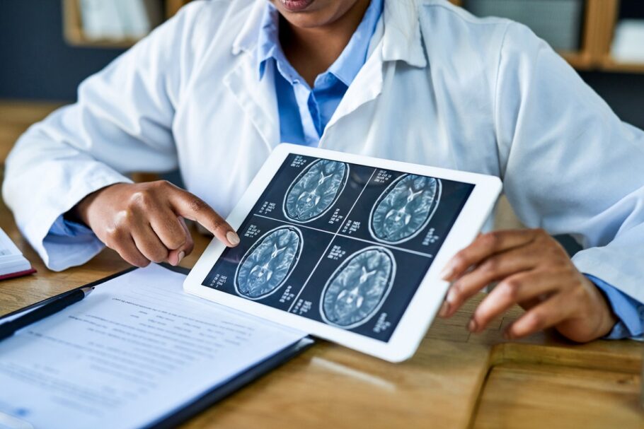 6 sintomas que as pessoas ignoram mas podem ser aneurisma cerebral