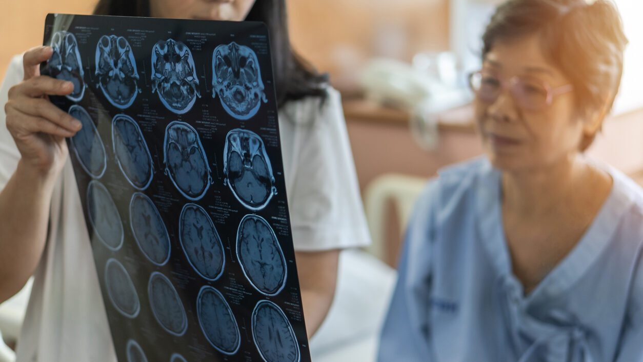 Tecnologia ajuda na detecção do Alzheimer antes dos sintomas surgirem