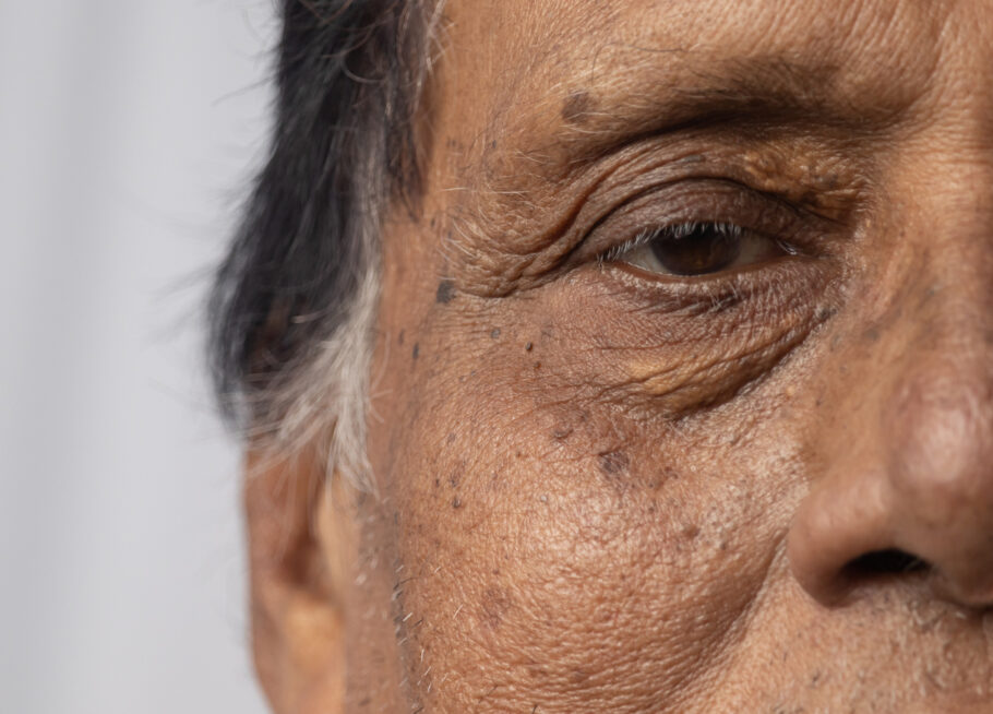 A doença de Alzheimer pode ser detectada pelos olhos, segundo estudo