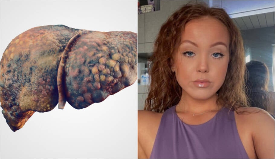 Ela tinha o fígado de um alcóolatra aos 10 anos de idade