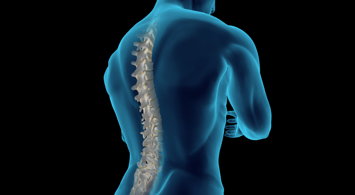 Condição rara que causa dores nas costas