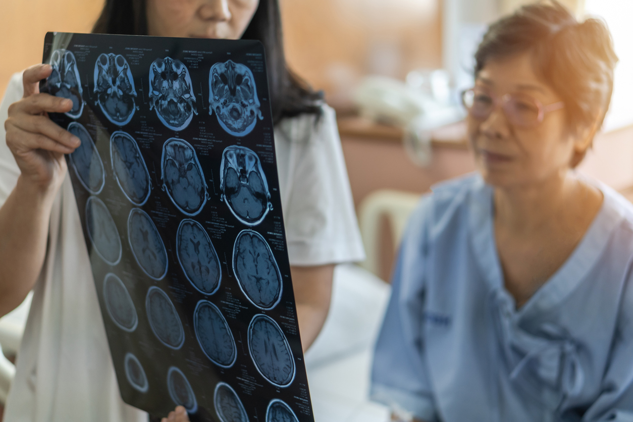 Pesquisas recentes encontraram relação entre condição de saúde aumento do risco de Alzheimer – iStock/Getty Images