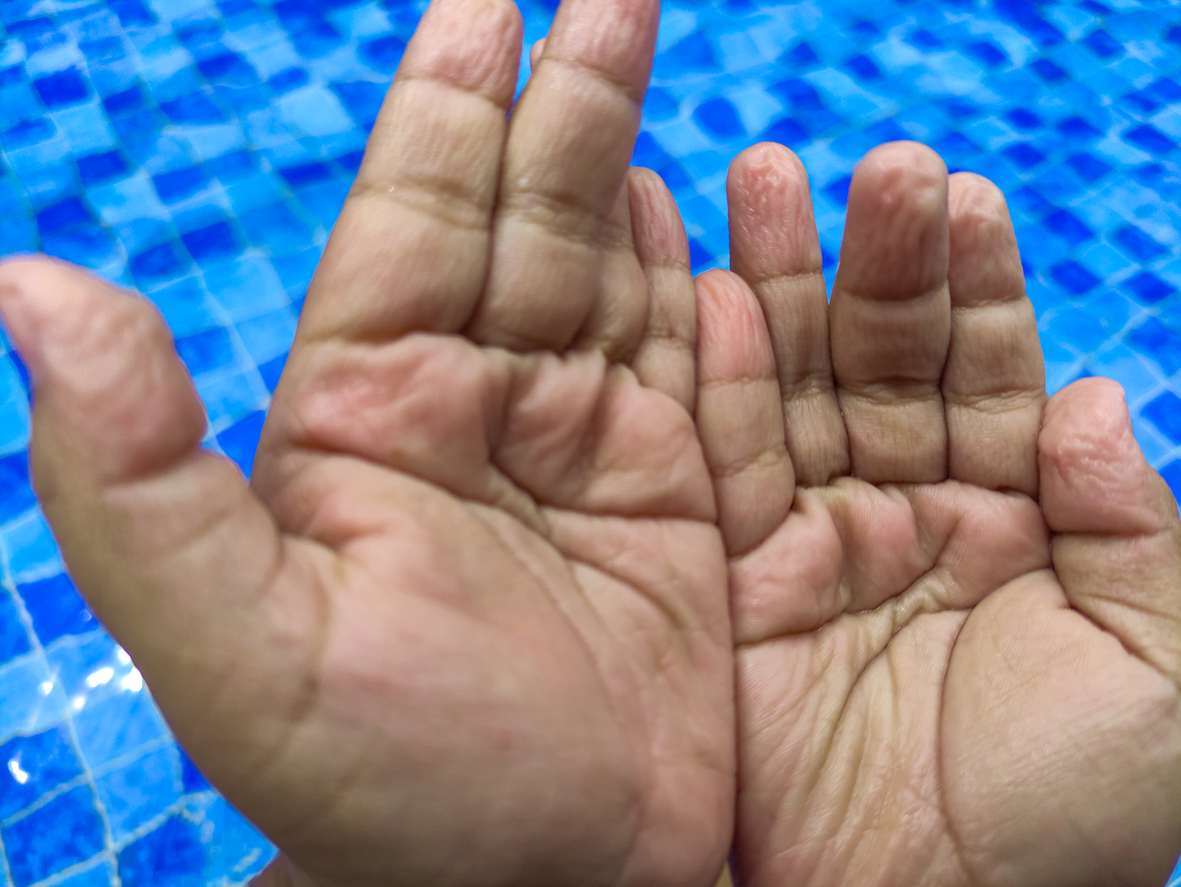 Por que os dedos ficam enrugados na água?