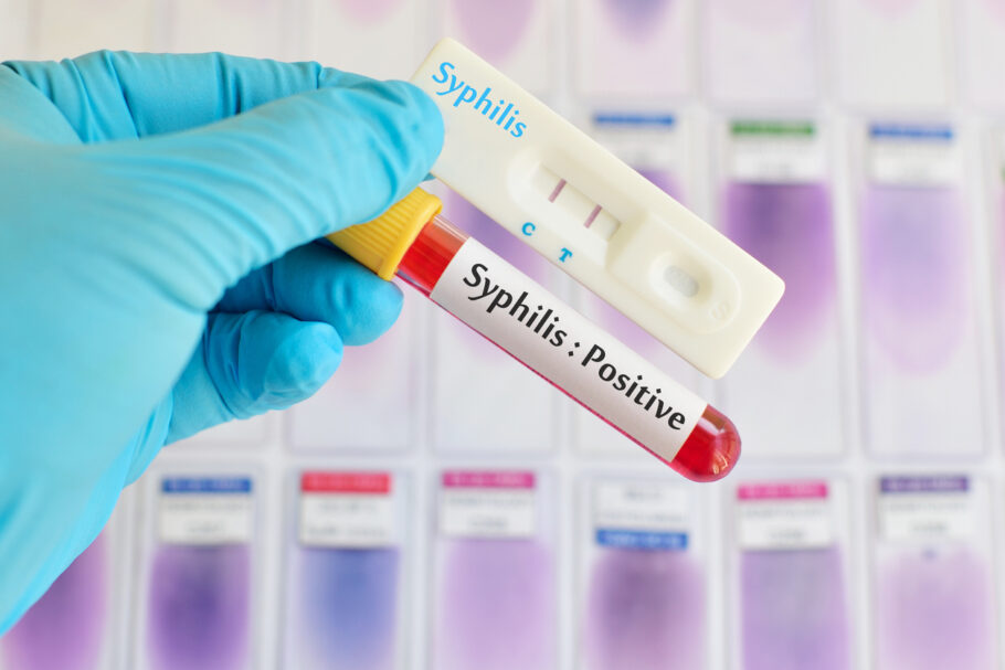 A sífilis congênita ocorre quando uma mãe infectada transmite a doença para o bebê