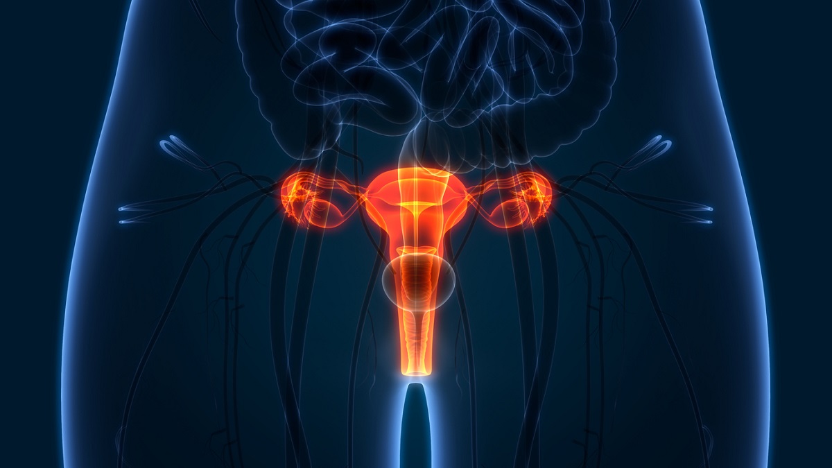 5 sintomas do câncer na vulva que não devem ser ignorados