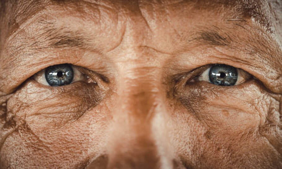 Em alguns casos, Alzheimer pode causar problemas na visão