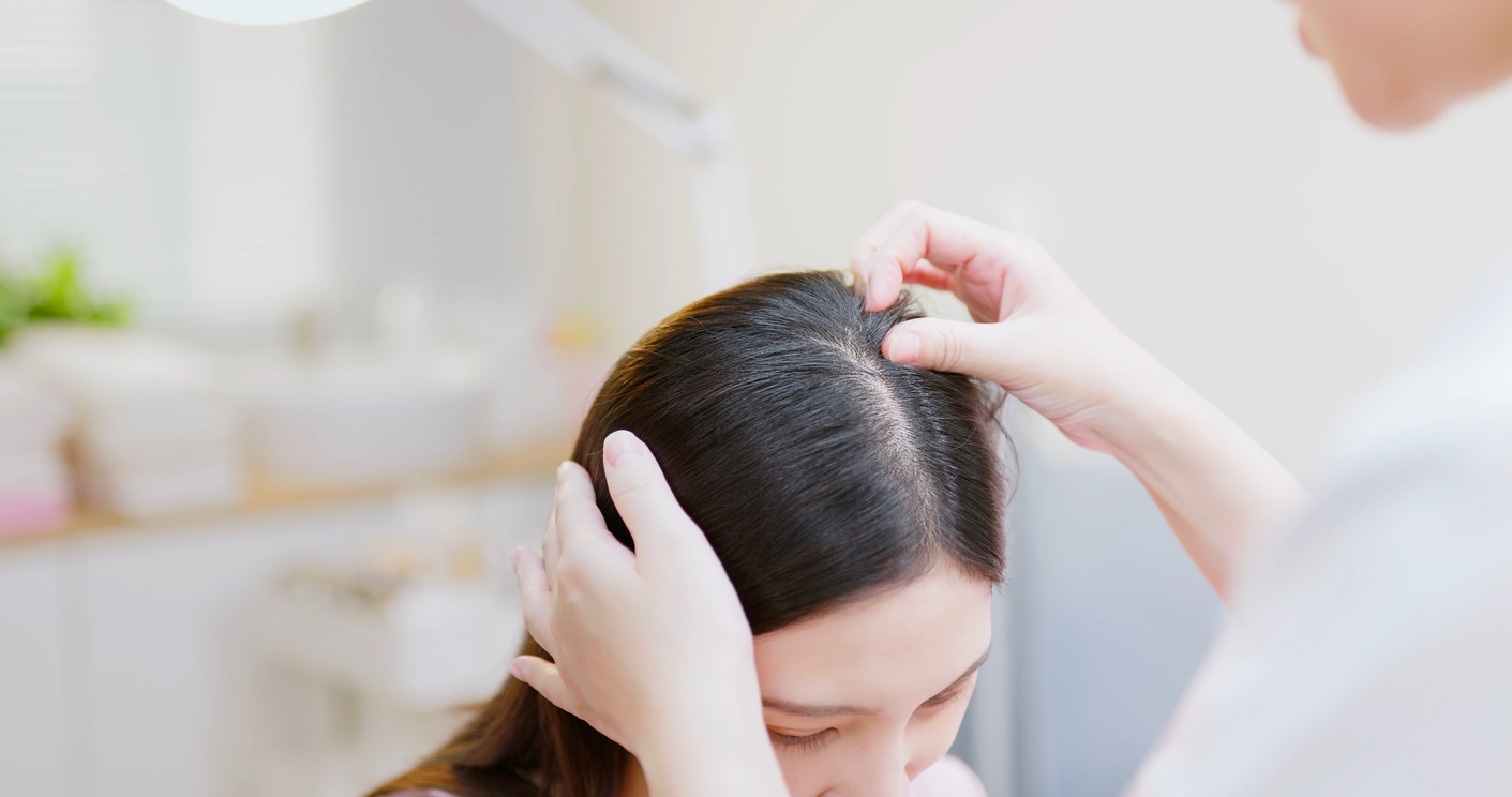 Menos comum, câncer de pele no couro cabeludo se caracteriza por difícil detecção da doença – iStock/Getty Images
