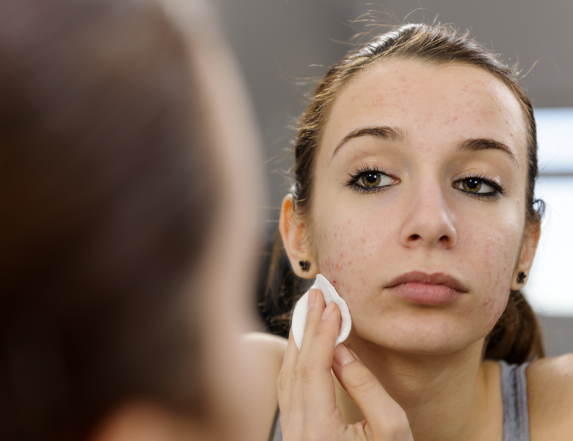 Durante o verão, especialistas sugerem que o rosto seja lavado entre duas e três vezes ao dia – iStock/Getty Imags