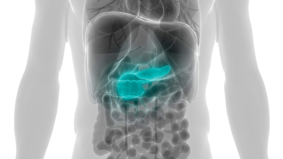 Problemas digestivos podem ocorrer em casos avançados de câncer de pâncreas