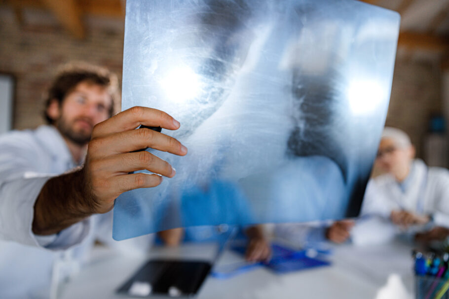 Surtos de Pneumonia do ‘pulmão branco’ se espalha e quais são os sintomas