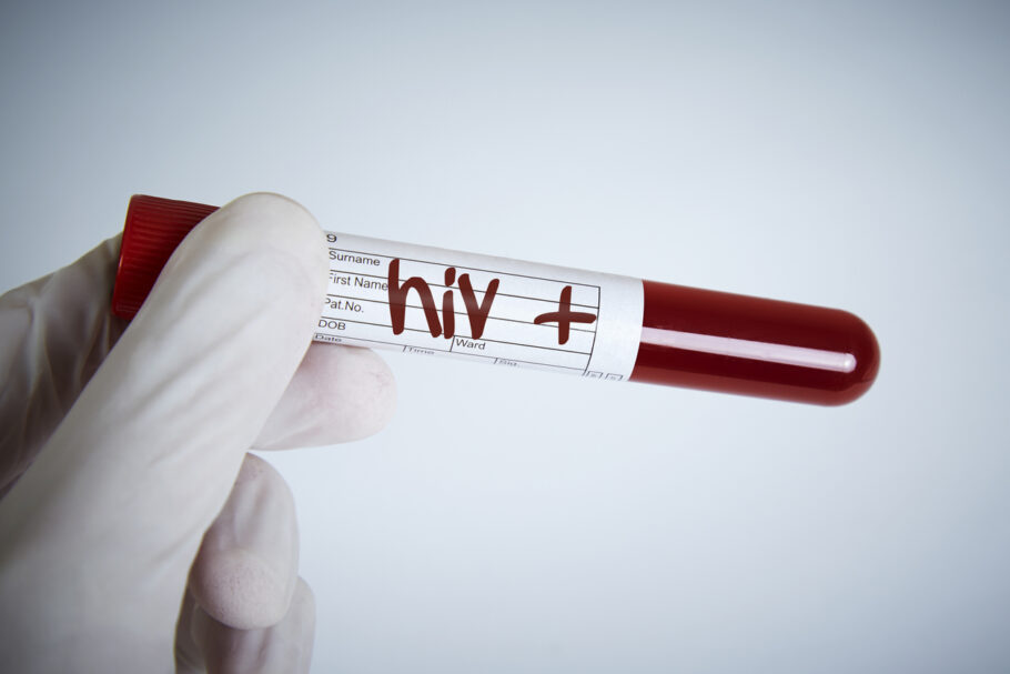 O HIV enfraquece a capacidade do organismo de combater infecções e doenças