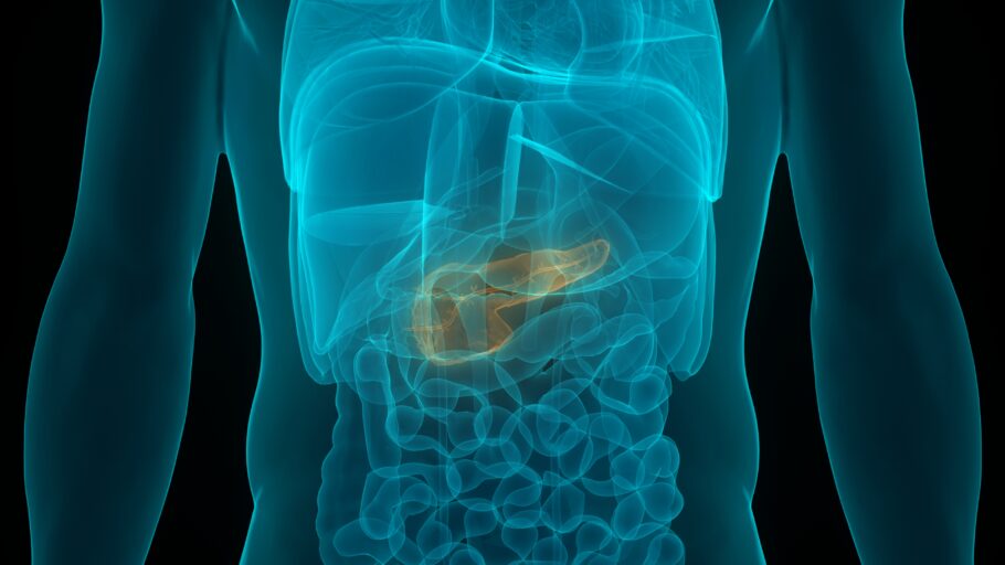 Obesidade, tabagismo e outras condições aumentam o risco do câncer de pâncreas