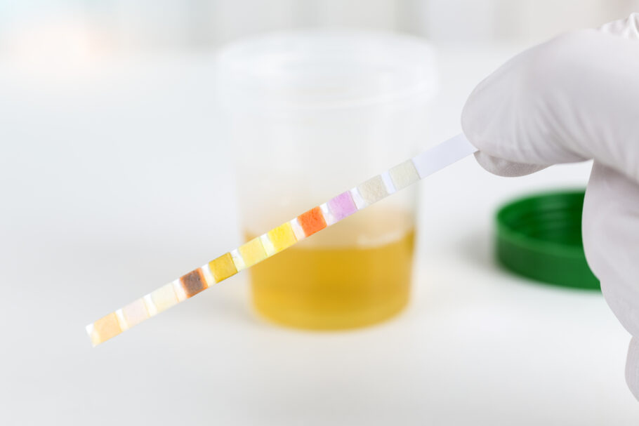 Estudo indica razão por trás da urina amarela