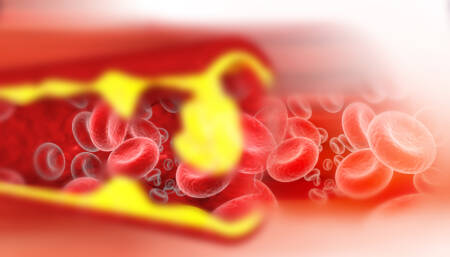 colesterol ruim doenças crônicas