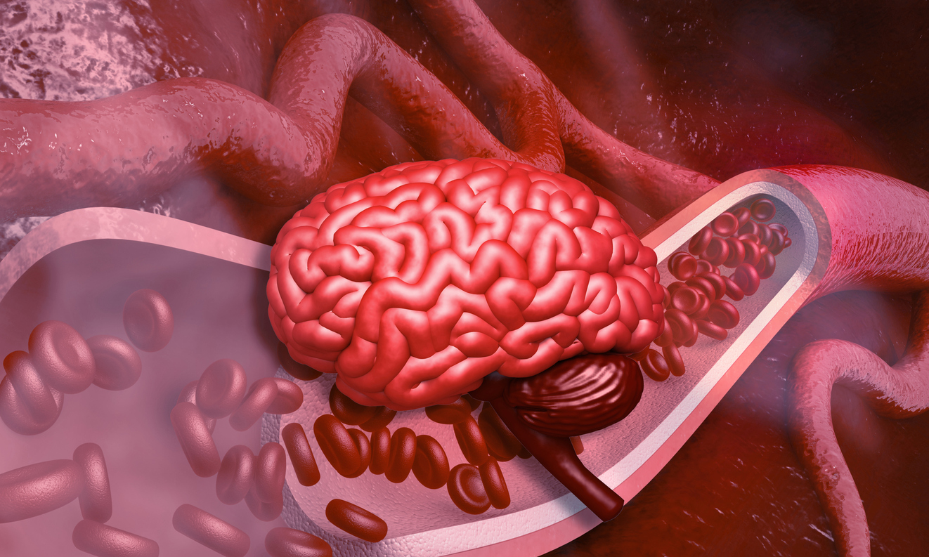 Gordura abdominal está ligada ao Alzheimer, revela estudo