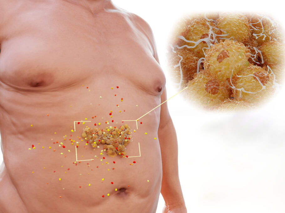 A gordura visceral fica ao redor dos órgãos internos como o fígado, intestinos e pâncreas