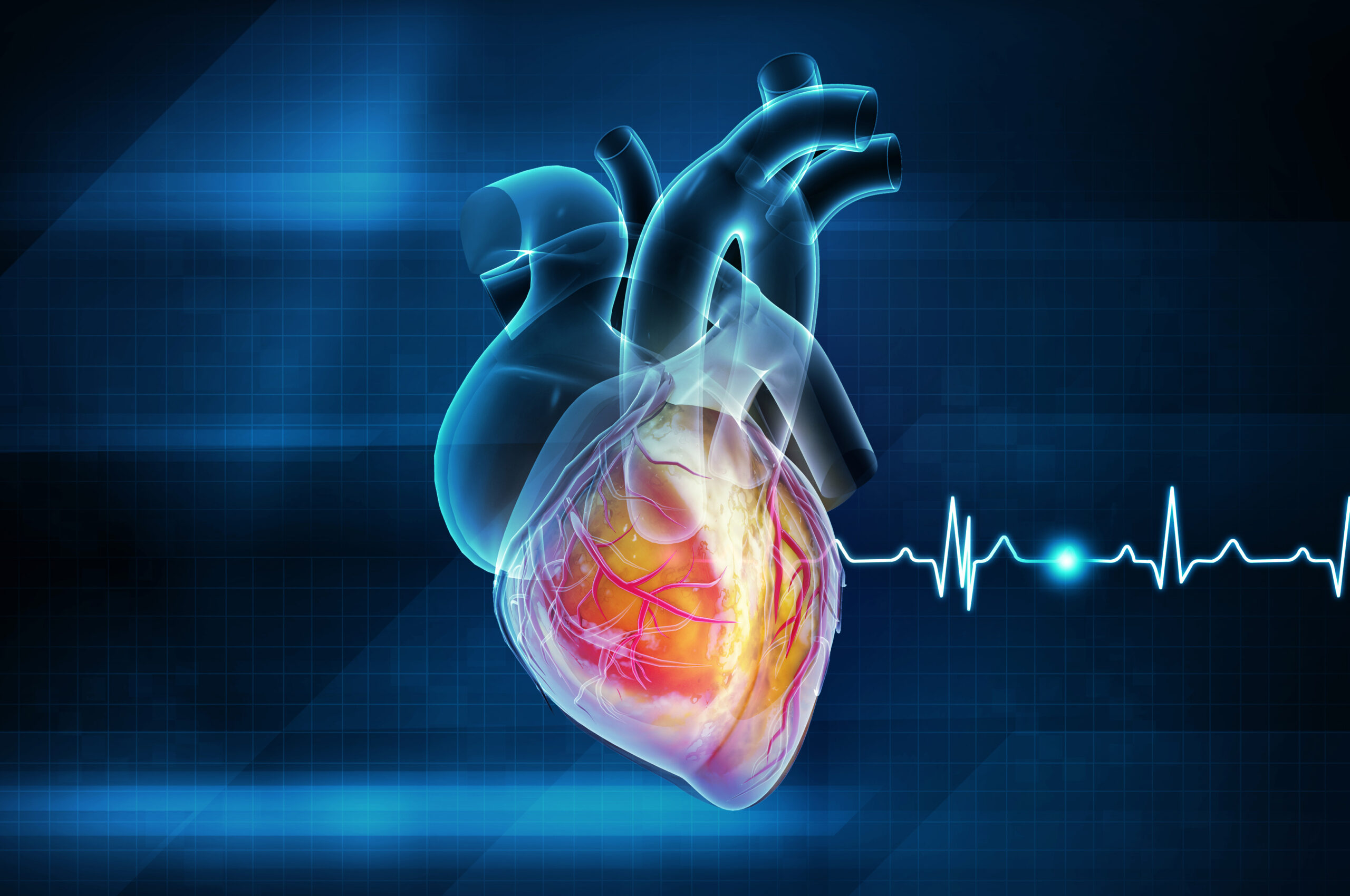 Então, descubra como reconhecer infarto sem dor no peito