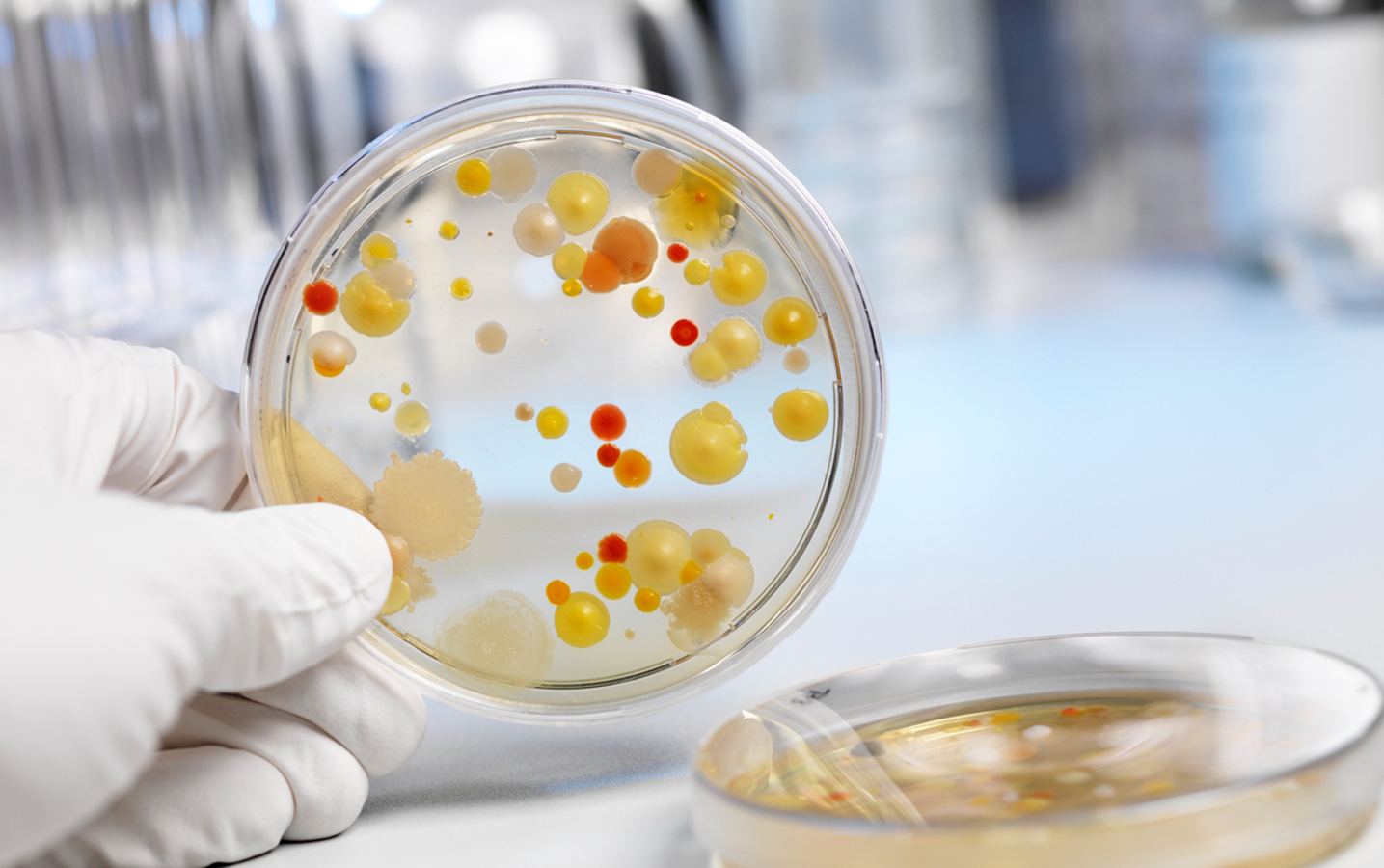 OMS atualiza lista de bactérias perigosas à saúde humana