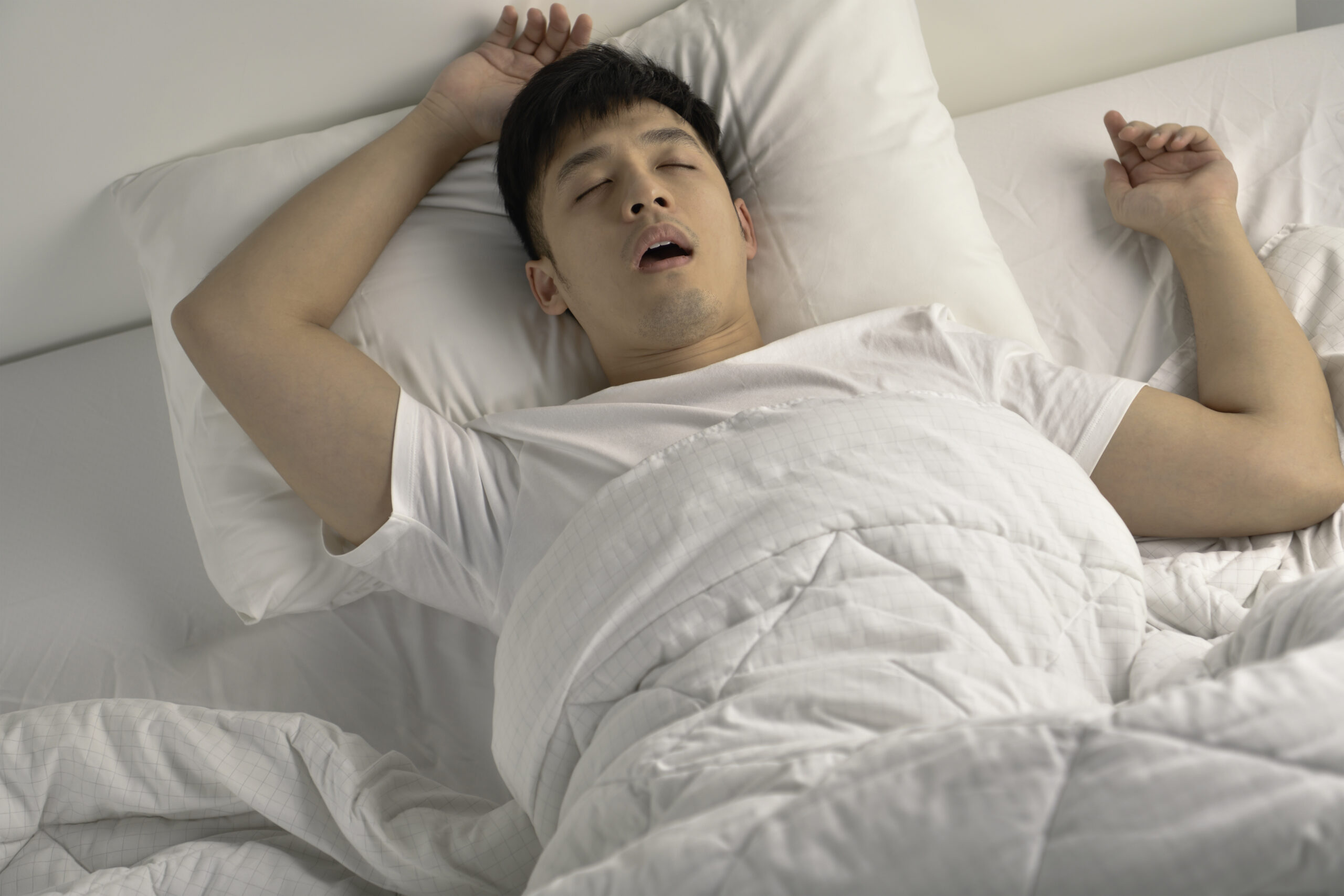 A importância da homocisteína para prever apneia do sono