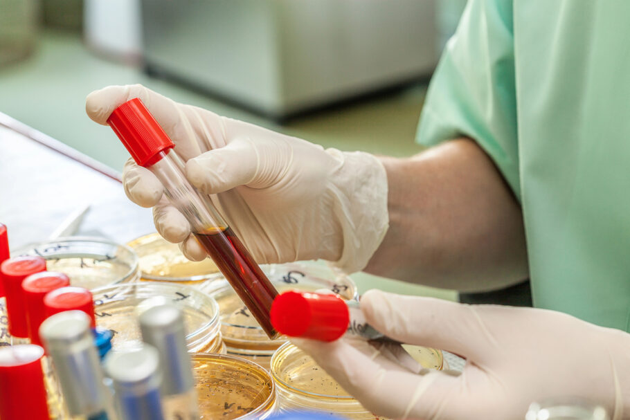Exame de sangue pode identificar proteínas relacionadas a diferentes tipo de câncer
