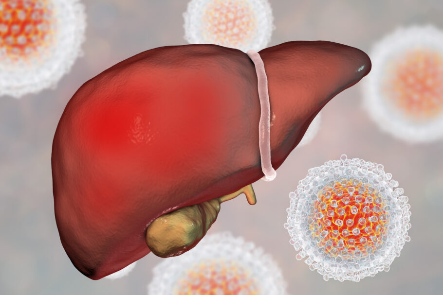 A hepatite A é uma infecção viral que afeta o fígado, causada pelo vírus da hepatite A (HAV)
