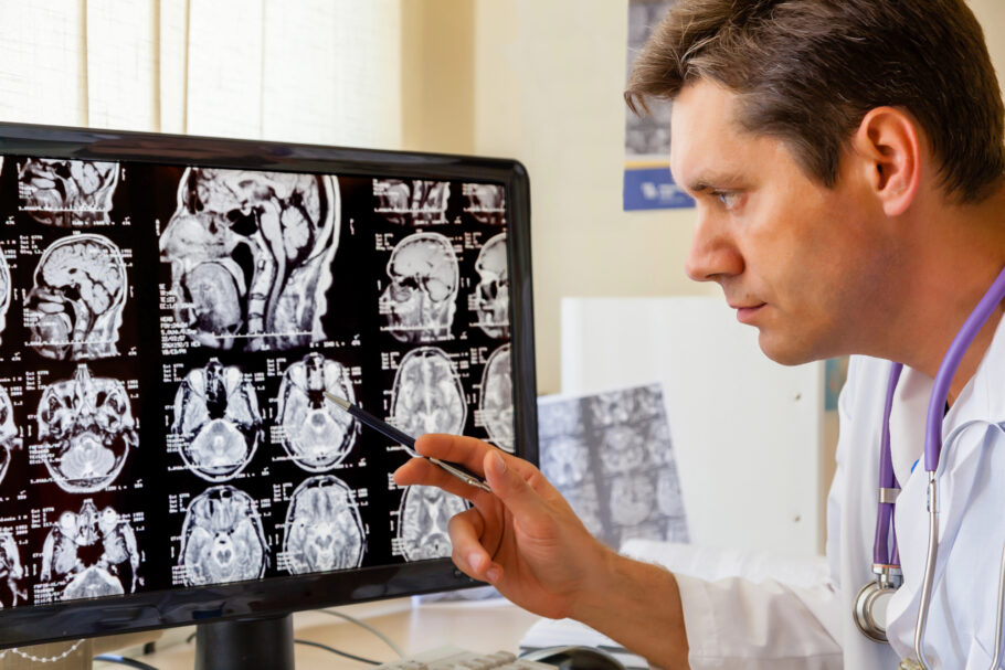Novo exame para diagnosticar demência analisa imagem de ressonância magnética cerebral