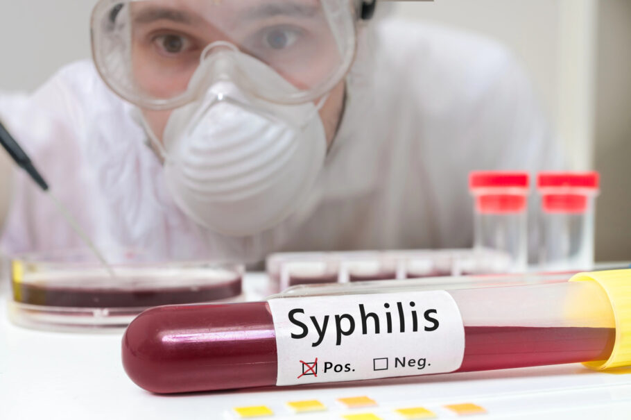Exame de sangue pode diagnosticar a sífilis