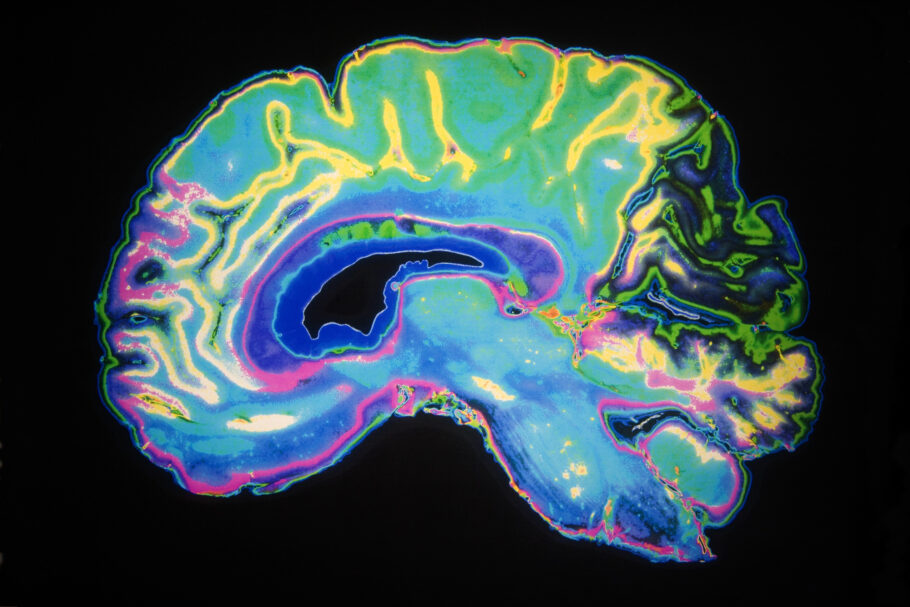 Pesquisadores descrevem novo tratamento que reverte sinais da doença de Alzheimer
