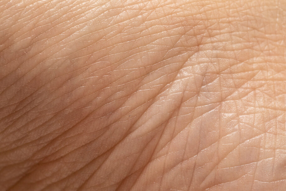 Alteração na cor da pele em certas regiões do corpo pode indicar diabetes