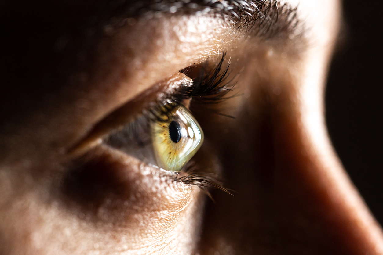 Pacientes com ceratocone frequentemente precisam de cuidados oftalmológicos especializados para preservar a visão