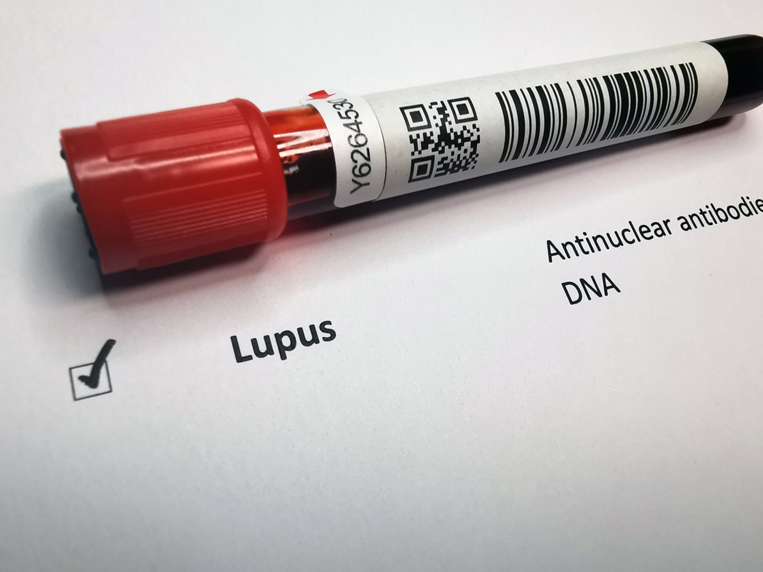 Cientistas sugerem novo tratamento para lúpus; veja possível causa da doença apontada em estudo