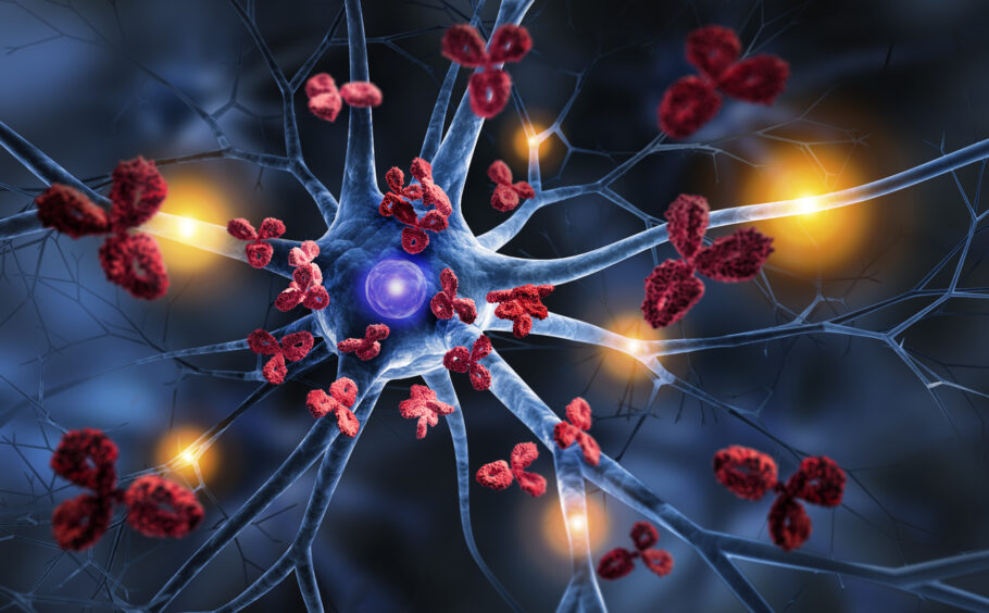 Pesquisadores descobrem que pessoas com esclerose múltipla (EM) podem ter mais proteção contra a doença de Alzheimer.