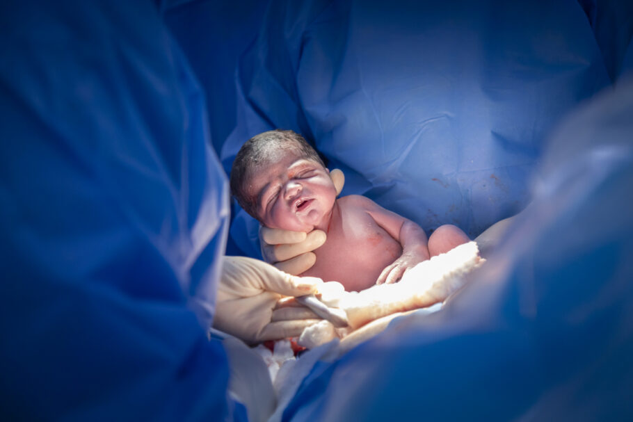 Pesquisa identifica uma possível relação entre ácidos graxos presentes no sangue do cordão umbilical e o risco de autismo