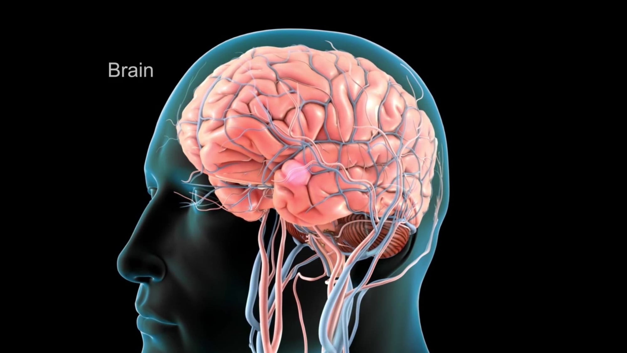 Sinais de AVC para não negligenciar
