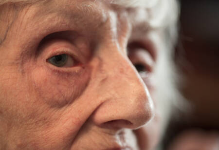 A redução em apenas 15% na prevalência desses hábitos já seria o suficiente para evitar “dezenas de milhares de casos” de demência