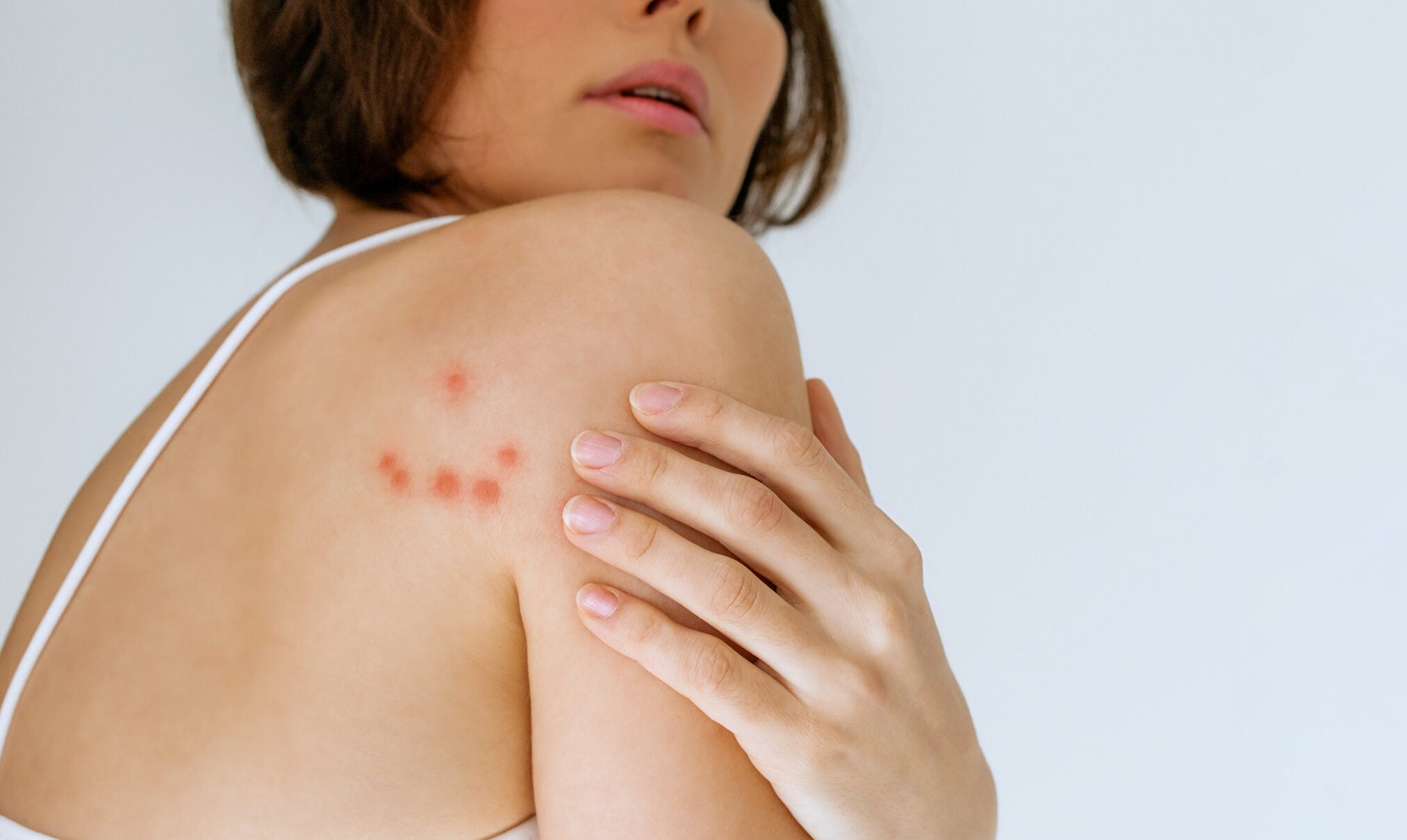 Saiba como prevenir percevejos em sua casa