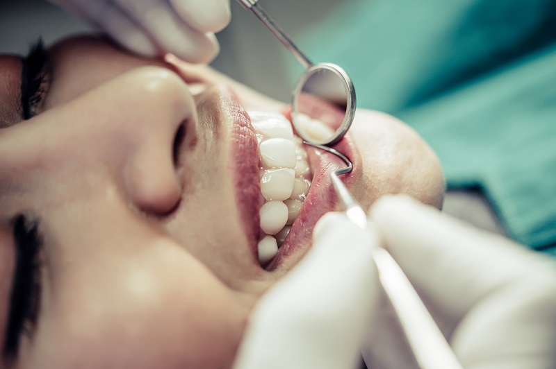 Manter uma boa higiene oral e visitas regulares ao dentista minimiza o surgimento do problema, que afeta 90% da população mundial – Freekoik/Reprodução