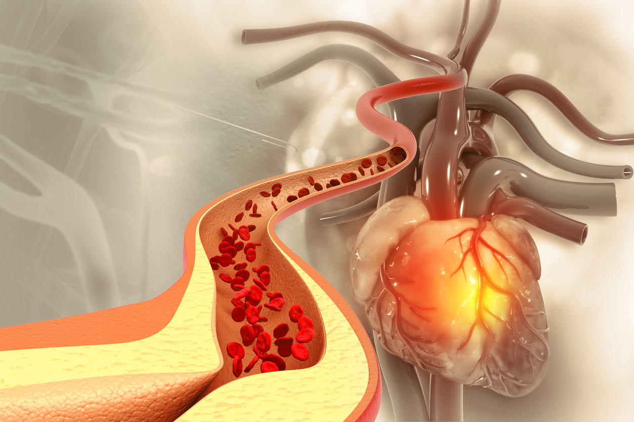 Saiba como reduzir o colesterol ruim para evitar doenças crônicas