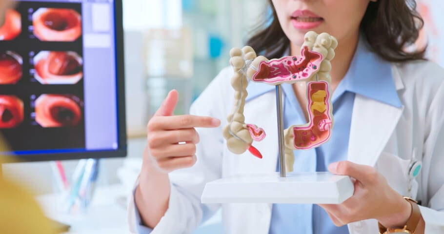 Estudo alerta para o consumo de carne vermelha e processada que pode aumentar o risco de câncer colorretal