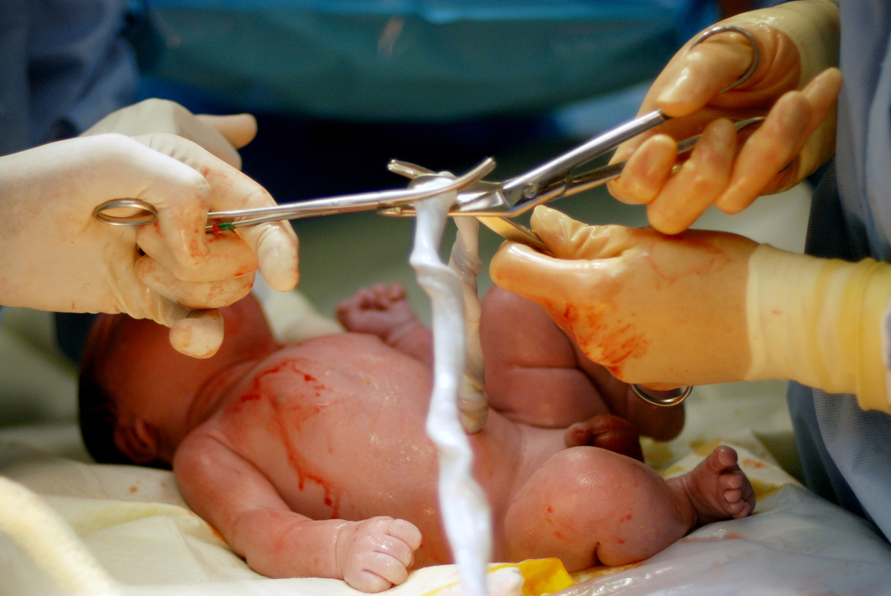 Amostras de sangue do cordão umbilical foram analisadas para investigar biomarcadores do TEA.