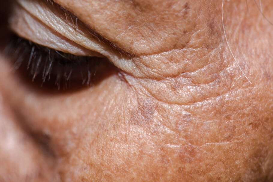 Pesquisadores descobrem envolvimento de hormônios no processo de envelhecimento da pele e cabelo