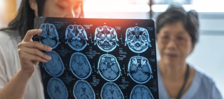 Pacientes com Alzheimer passam a ter novo tratamento no SUS