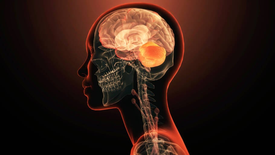 Pacientes com Alzheimer passam a ter novo tratamento no SUS