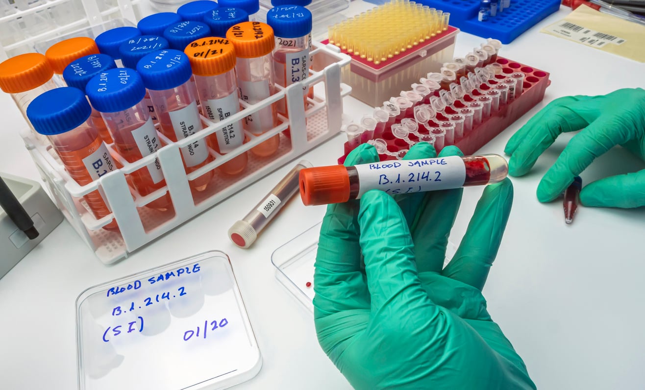 Compatibilidade sanguínea: o que todo mundo deveria saber antes de doar ou receber sangue.