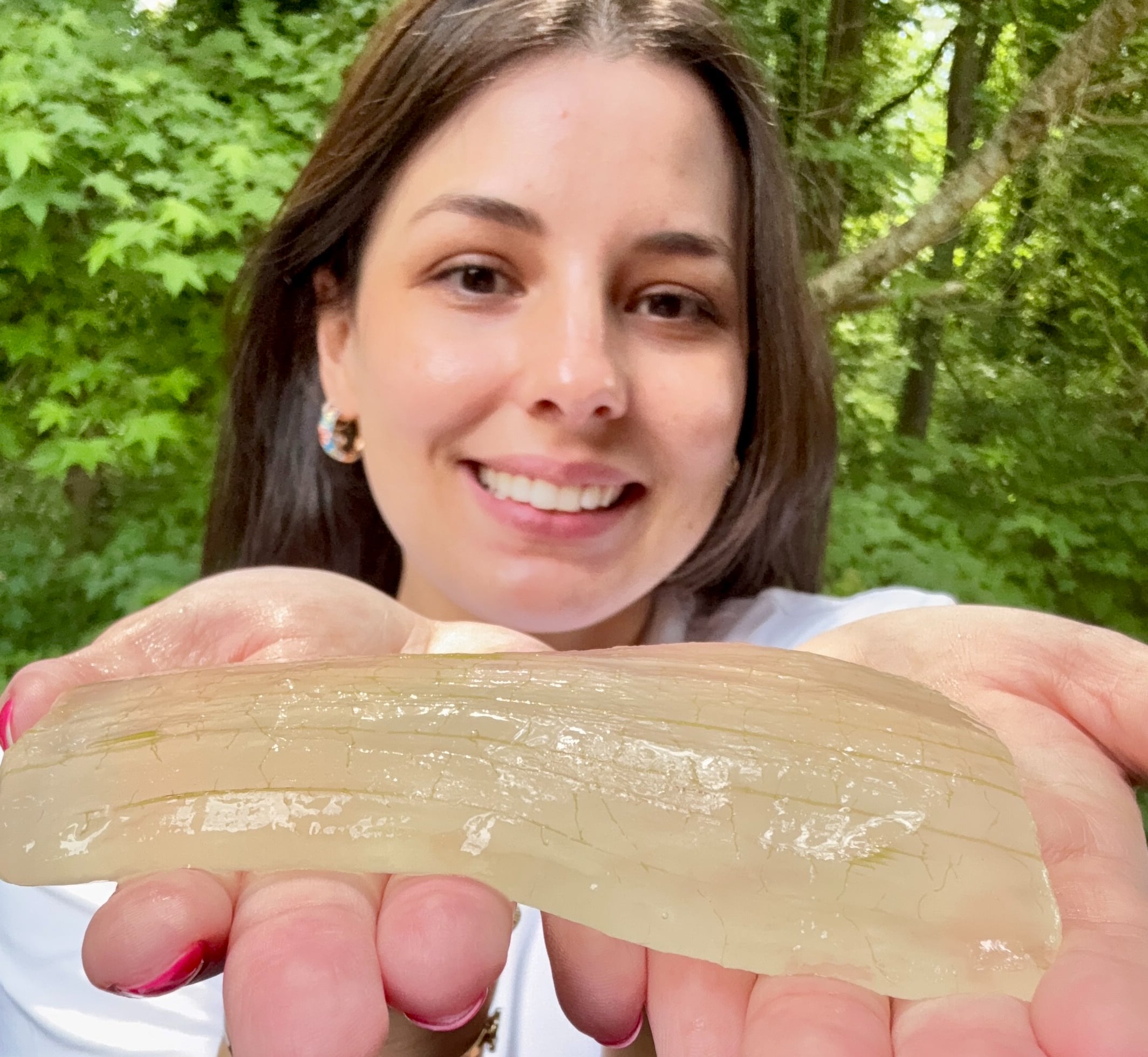 Aloe vera virou um dos pilares do tratamento natural de Daiany.
