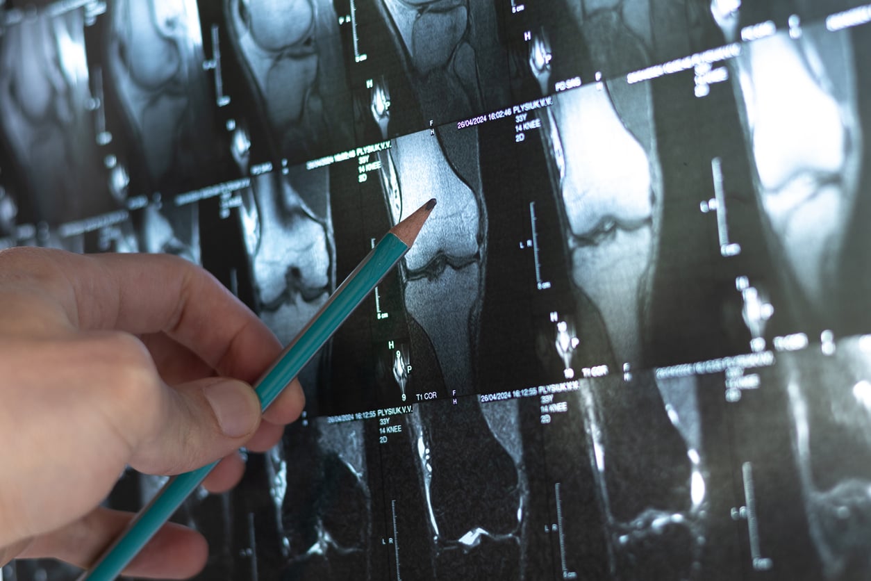 7 exames que toda mulher deveria fazer, mas que muitas ainda adiam