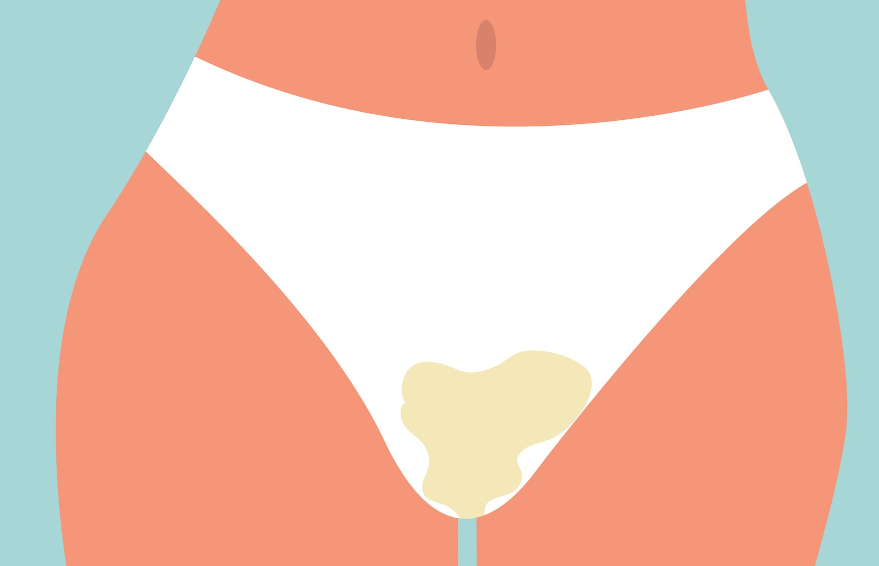 Tipos de corrimento feminino.