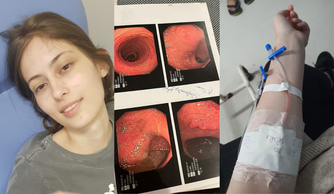 Com o diagnóstico e o tratamento adequados, Sara passou a controlar a doença por meio de cuidados com a alimentação e a saúde mental.